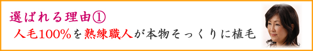 オーダーメイド人毛医療用かつらの特徴