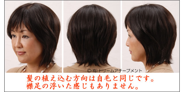 医療用かつらの見た目