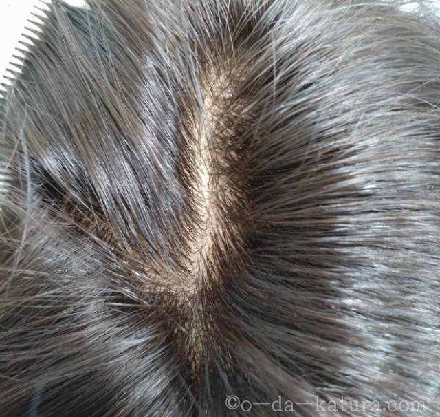 男性用、自分の髪(地毛・自毛）で造るかつら（キューティクル付き自然加工）