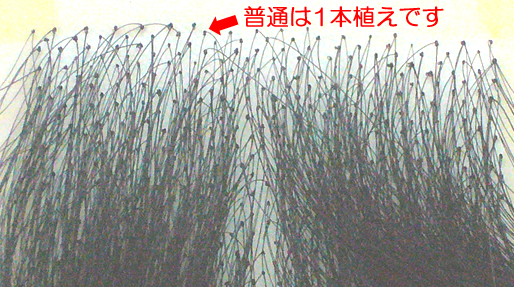 かつらの髪は1本植えなの それとも何本もまとめて植えるの 自毛 地毛 かつらウィッグ製作専門工房