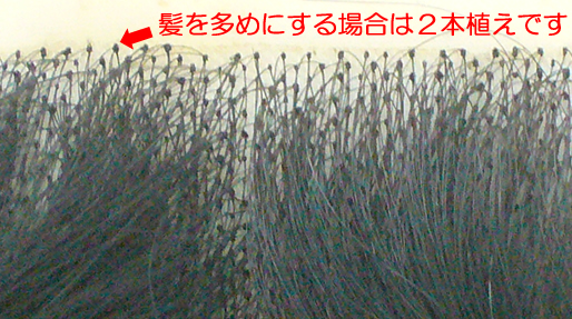 かつらの髪は1本植えなの それとも何本もまとめて植えるの 自毛 地毛 かつらウィッグ製作専門工房