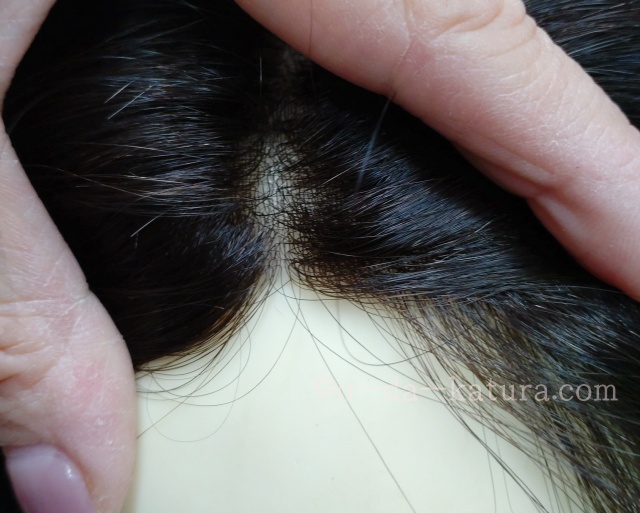 男性用。自分の髪(地毛・自毛）で造るかつらの生え際の極薄スキン