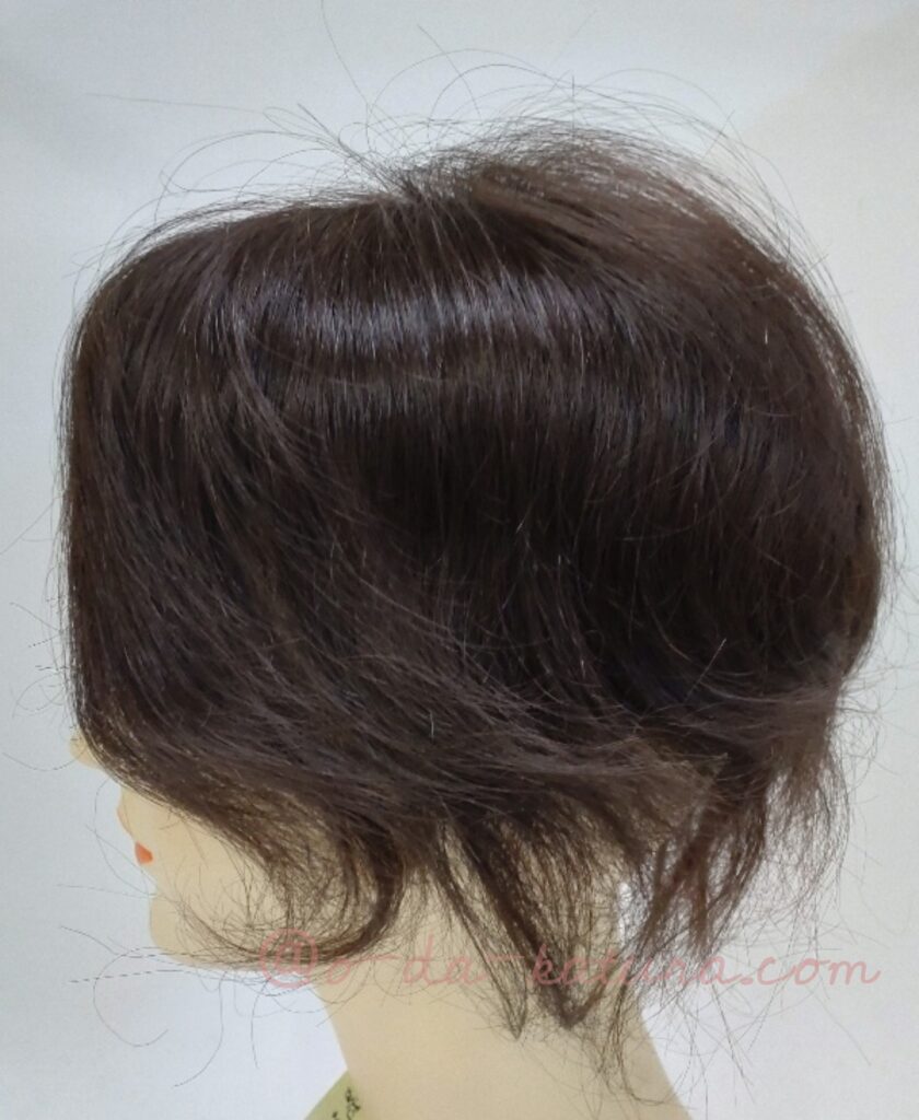 50年前の自毛ヘアピースをリフォームした部分ウィッグの側面