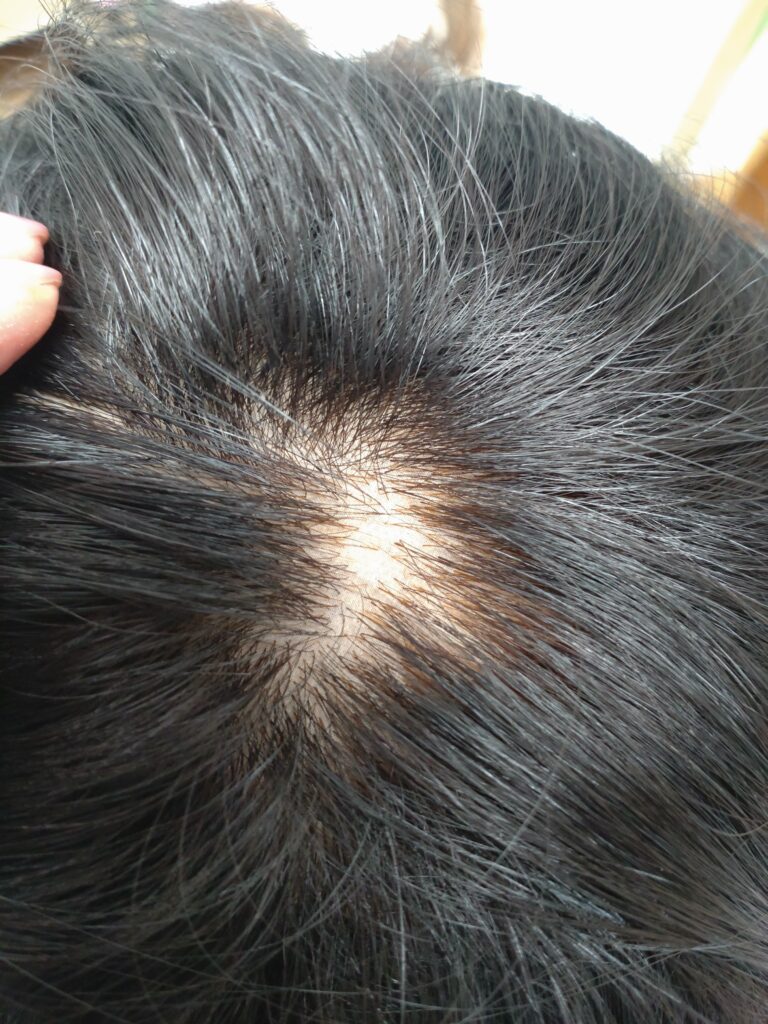 増毛前