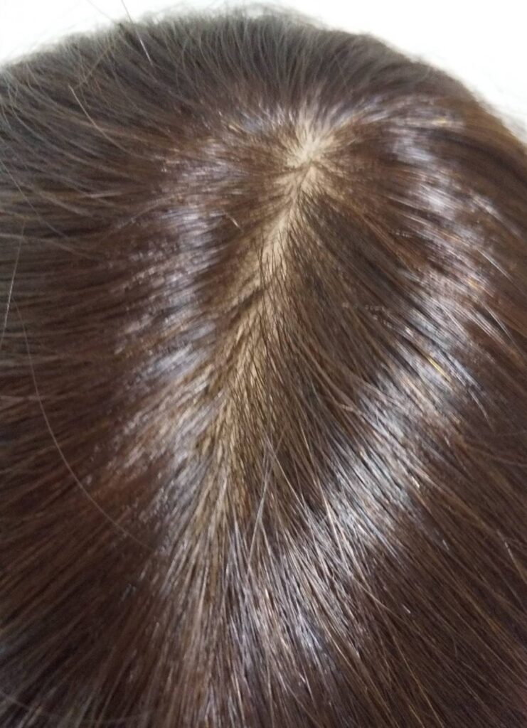 40cmのロングヘアを活かした自毛と人毛ブレンドの部分ウィッグのつむじ分け目