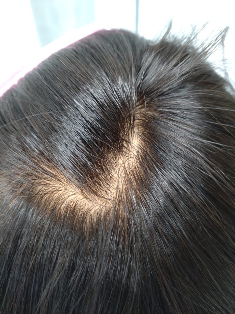 人毛キューティクル付き・ロングヘアフルウィッグの分け目つむじ