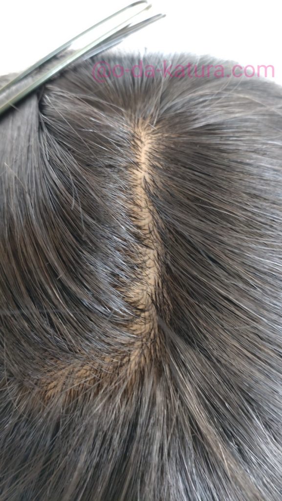 キューティクル付き人毛100%で作ったロングヘアの医療用ウィッグを上から見たところ