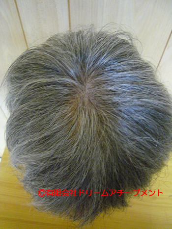 ご家族の自毛約50cmで作った白髪入りのおばあちゃん向け医療用ウィッグを上から見たところ