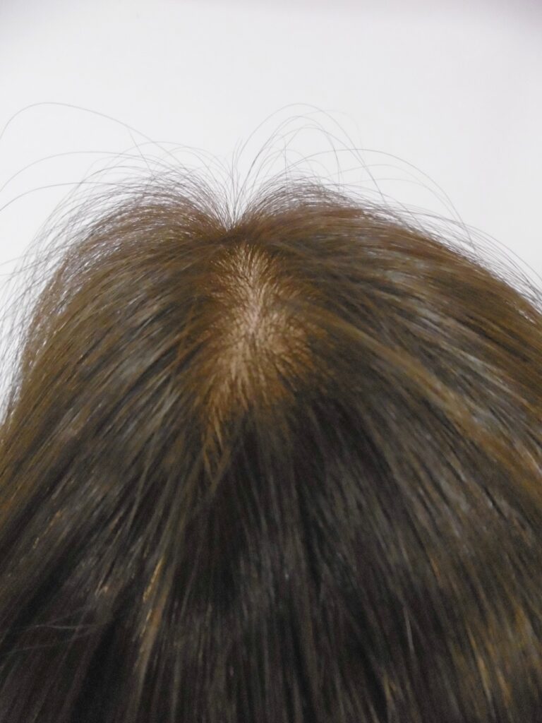 妹さんの自毛約25〜30cmで作ったお姉さんへの明るめの医療用ウィッグを上から見たところ