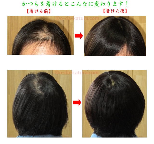 ウィッグを着ける前と後はこんなに変わります