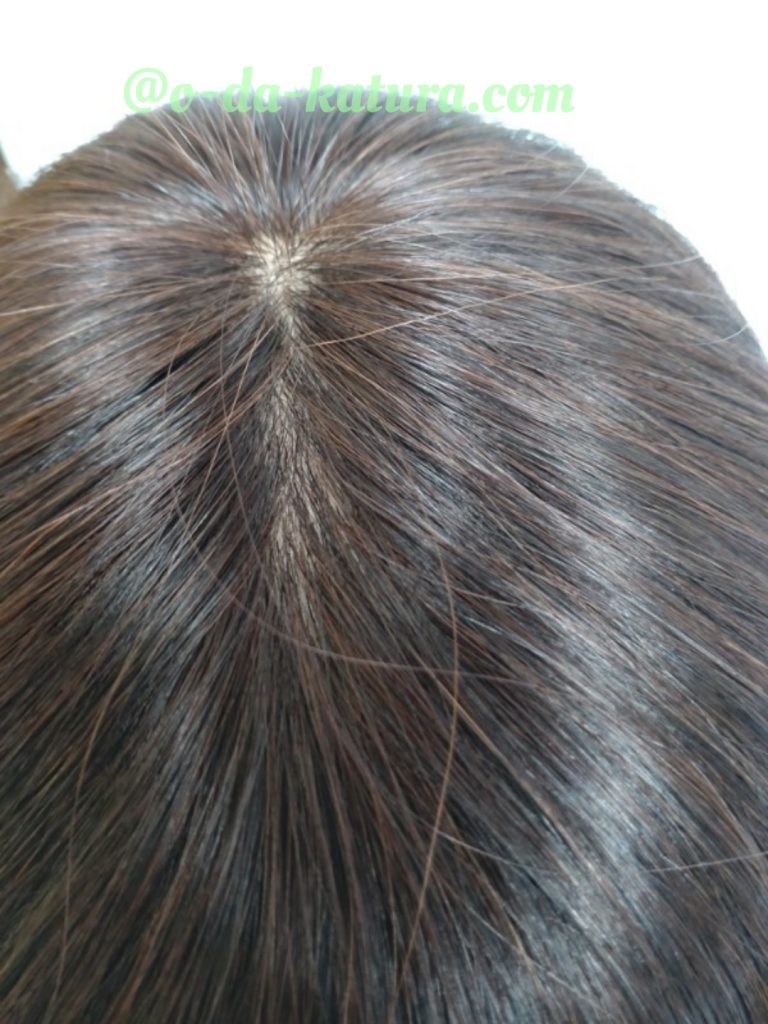 自毛35cmで作った部分ウィッグの頭頂部
