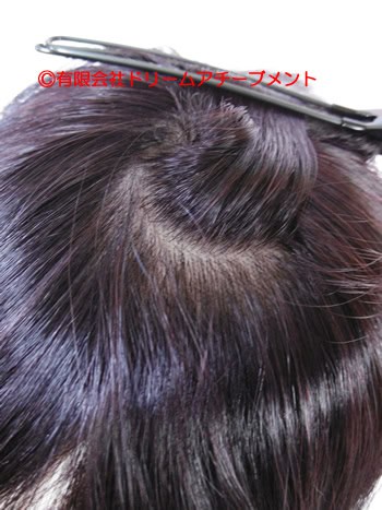 ヘアピースの頭頂部