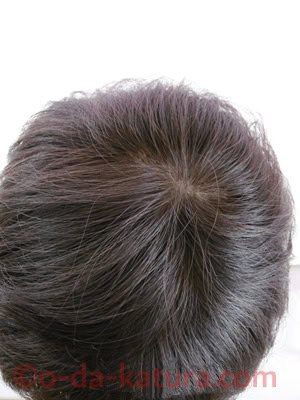 若々しく、活動的に。自毛(地毛)の個性を活かしたショートヘアスタイルの部分ウィッグの頭頂部