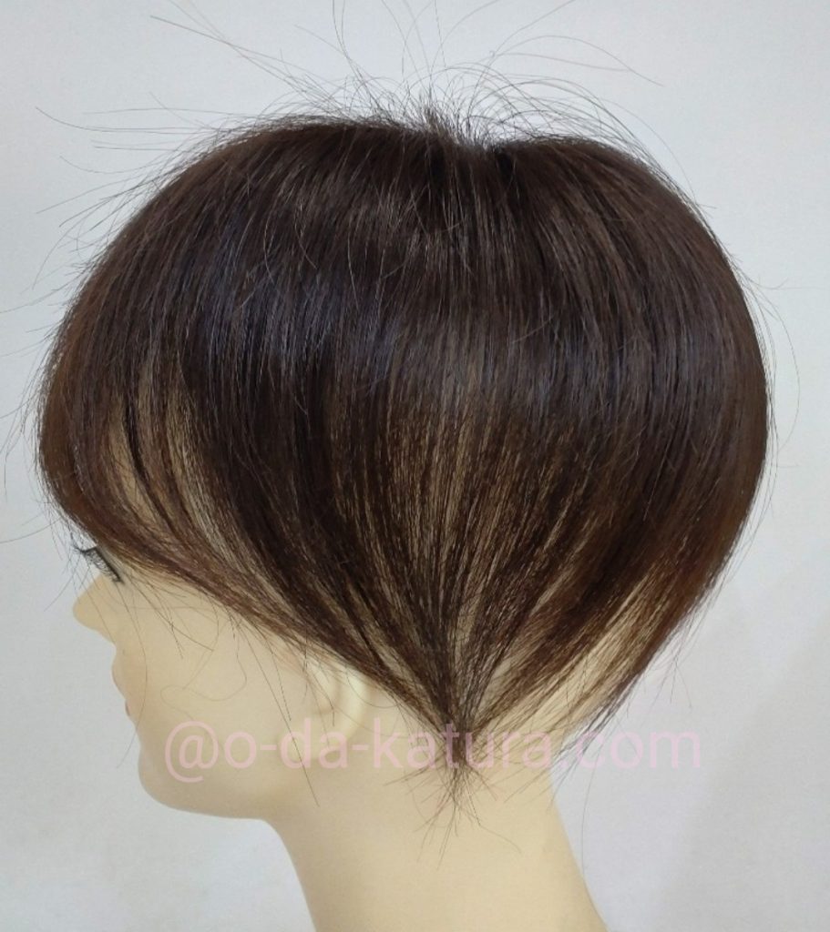 自毛ヘアピースを作り替えた「部分ウィッグ」の側面