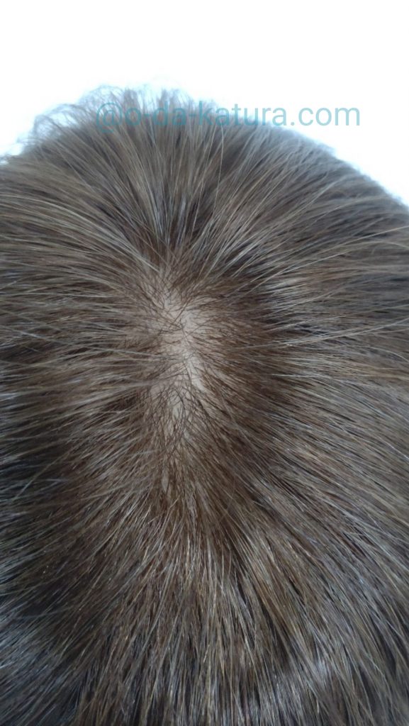 ヨーロピアンヘアウィッグの頭頂部