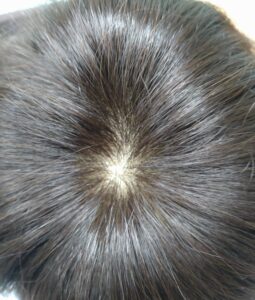 つむじ用に作った人毛100%のヘアシート